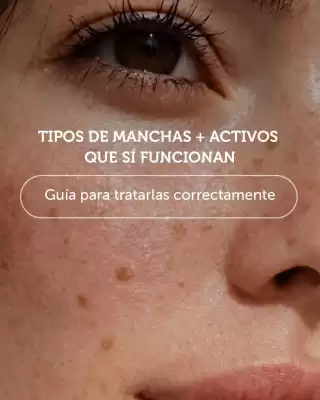Laboratorio LACA (válido hasta 31-07)
