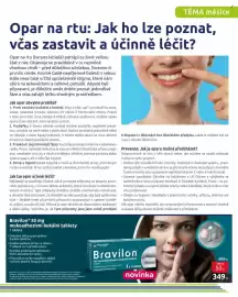 Benu leták Strana 9: Bravilon 50 mg mukoadhezivní bukální tablety €349,00