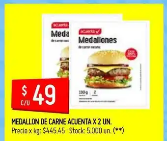Acuenta Medallon De Carne x 2 Un