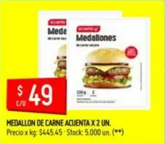 Changomas Acuenta Medallon de Carne x 2un. oferta