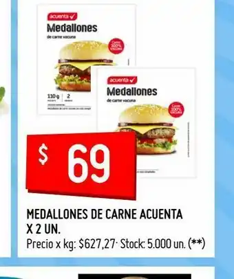 Changomas Medallones de carne acuenta x 2 un oferta