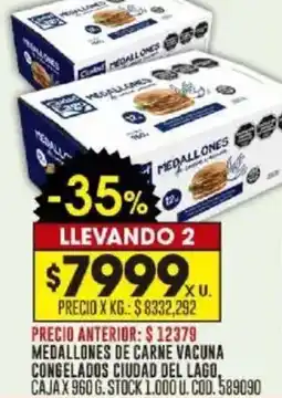 Coto Medallones de carne vacuna congelados ciudad del lago caja oferta