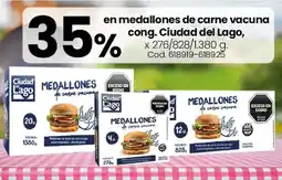 Coto Ciudad del lago en medallones de carne vacuna cong oferta