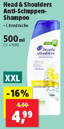 Thomas Philipps Head & Shoulders Anti-Schuppen Shampoo Angebot
