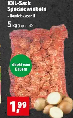 Thomas Philipps Xxl sack speisezwiebeln Angebot