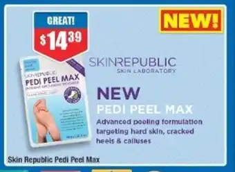 Chemist Warehouse Skin Republic Pedi Peel Max offer