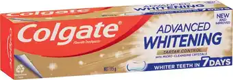 IGA Colgate Advanced Whitening or MaxFresh Toothpaste 115g Selected Varieties offer