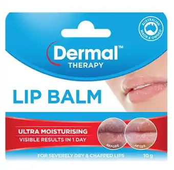 Superpharmacy Dermal therapy lip balm ultra moisturising 10g offer