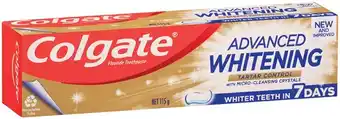 IGA Colgate Advanced Whitening or MaxFresh Toothpaste 115g Selected Varieties offer