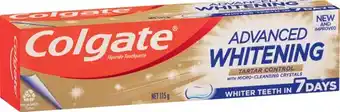 IGA Colgate Advanced Whitening or MaxFresh Toothpaste 115g Selected Varieties offer