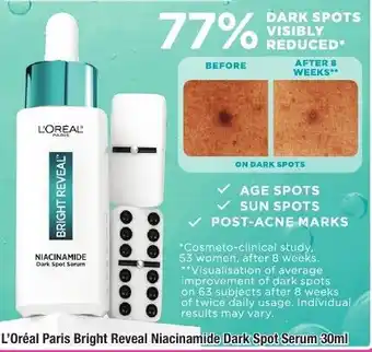 Chemist Warehouse L'Oréal Paris Bright Reveal Niacinamide Dark Spot Serum 30ml offer