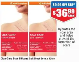 CICA-CARE Scar Treatment