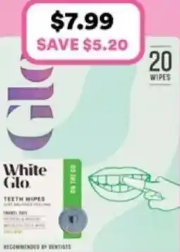 Priceline Teeth wipes offer