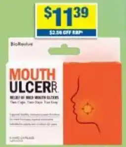 My Chemist Mild mouth ulcer relief + immunity support offer