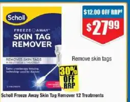 Chemist Warehouse Scholl freeze away skin tag remover 12 treatments offer