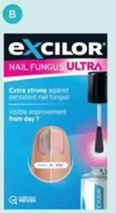 Your Local Pharmacy Nail Fungus Treatment Ultra offer