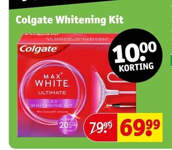 Kruidvat Colgate whitening kit aanbieding