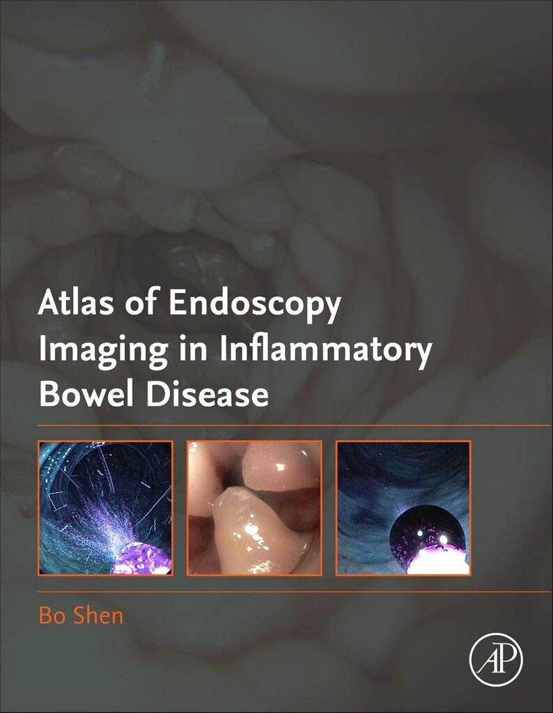 Bol.com Atlas of endoscopy imaging in inflammatory bowel disease aanbieding