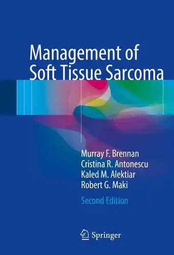 Bol.com Management of soft tissue sarcoma aanbieding