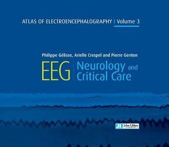 Bol.com Atlas of electroencephalography volume 3 aanbieding