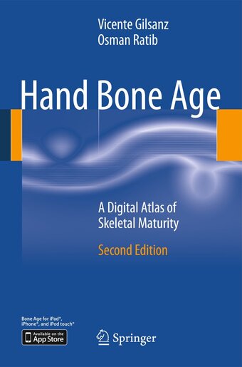 Bol.com Hand bone age aanbieding