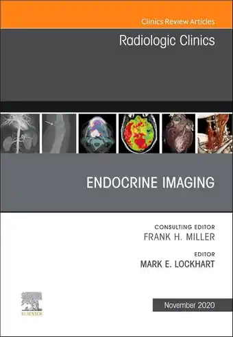 Endocrine Imaging , An Issue of Radiologic Clinics of North America