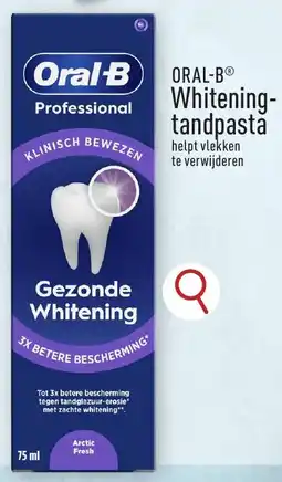 ALDI Oral-B Whitening Tandpasta aanbieding