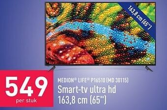 ALDI MEDION LIFE P16510 (MD 30115) Smart-tv ultra hd 163,8 cm 65`` aanbieding
