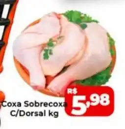 Super Rede Atacadista Coxa Sobrecoxa C/Dorsal oferta