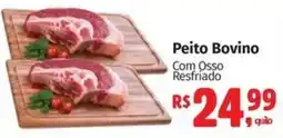Mix Mateus Peito Bovino Com Osso Resfriado oferta