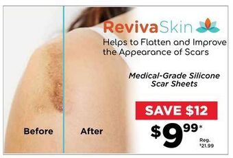 Showcase Medical-grade silicone scar sheets offer