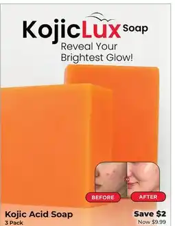 Showcase Kojic Acid Soap offer