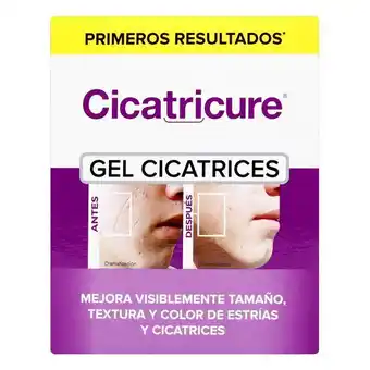 Farmacia San Jorge Cicatricure gel cicatrices 12 sobres x 8 g oferta