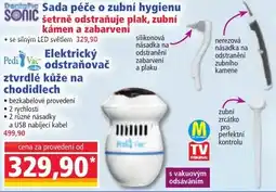 Norma Dentate Sada péče o zubní hygienu SONIC šetrně odstraňuje plak, zubní kámen a zabarveni nabídka