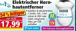 Norma Pedi Vac Elektrischer Horn- hautentferner Angebot