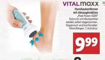 Marktkauf Vitalmaxx Hornhautentferner Mit Absaugfunktion Angebot