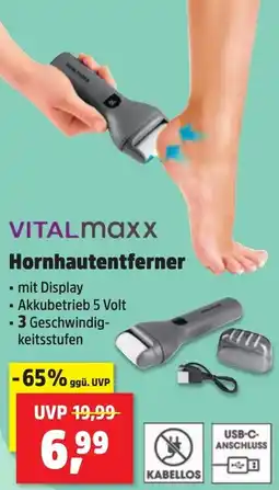 Thomas Philipps VITALmaxx Hornhautentferner Angebot