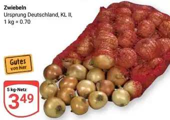 Globus Zwiebeln Angebot