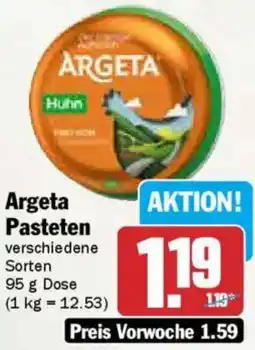 AEZ Argeta Pasteten Angebot