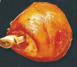 Edeka Bauern Gut Schweinshaxe Angebot