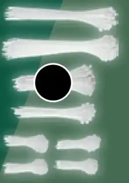 Kaufland Parkside Kabelbinderset Angebot