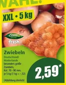 Norma Zwiebeln Angebot