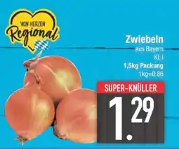 Edeka Zwiebeln Angebot