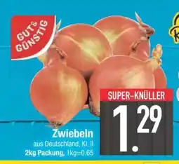 Edeka Zwiebeln Angebot
