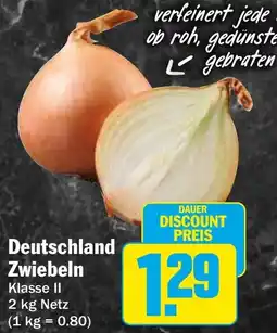 AEZ Deutschland Zwiebeln Angebot