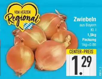 E-Center Zwiebeln Angebot