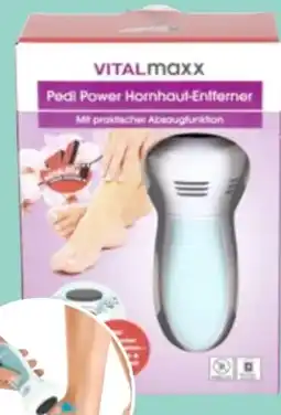 Thomas Philipps Vitalmaxx Hornhautentferner Angebot