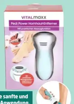 Thomas Philipps Vitalmaxx Hornhautentferner Angebot