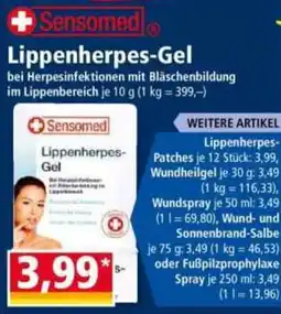 Norma Sensomed Lippenherpes-Gel Angebot