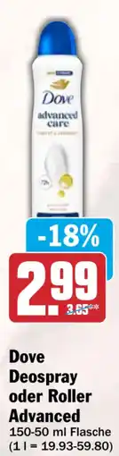 HIT Dove Deospray oder Roller Advanced Angebot